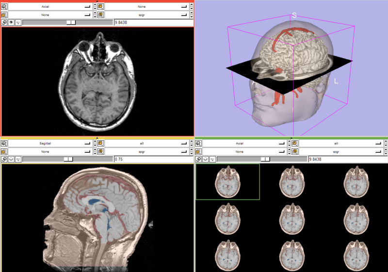 File:DataLoadingAndVisualization SPujol.png