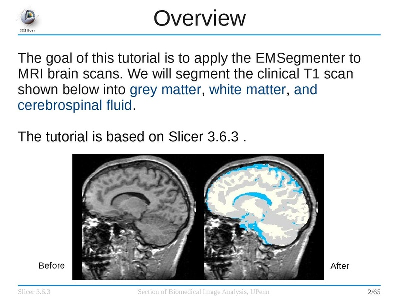 File:EMSegmenterTutorialAdvancedMode-Slicer-3.6.3-1.pdf