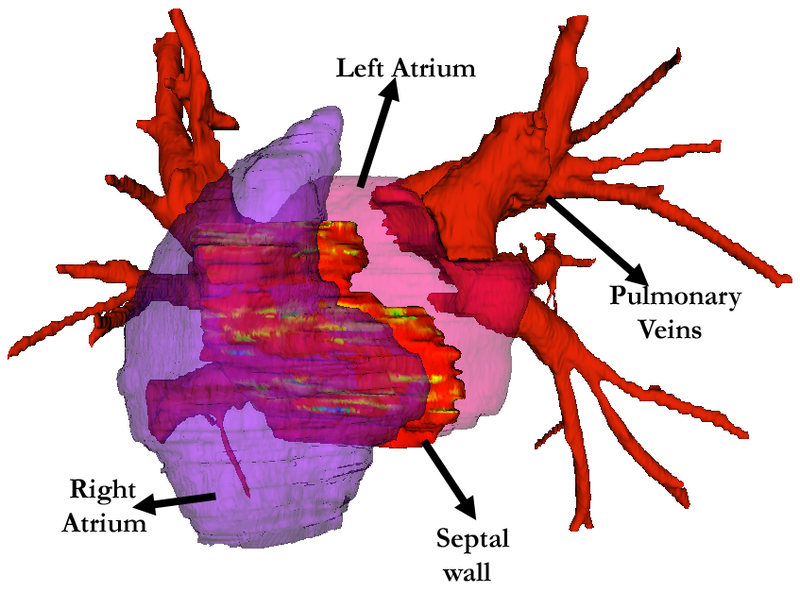 File:Jayender-IntJMedRobot2011-fig.png