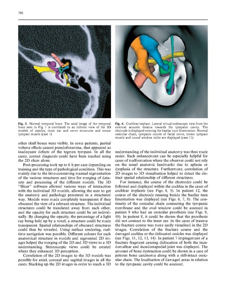 File:Rodt-Neuroradiology2002.pdf