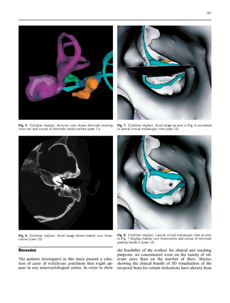 File:Rodt-Neuroradiology2002.pdf