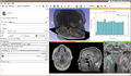 3D Slicer 4.0.1.2012-02-03 180.png