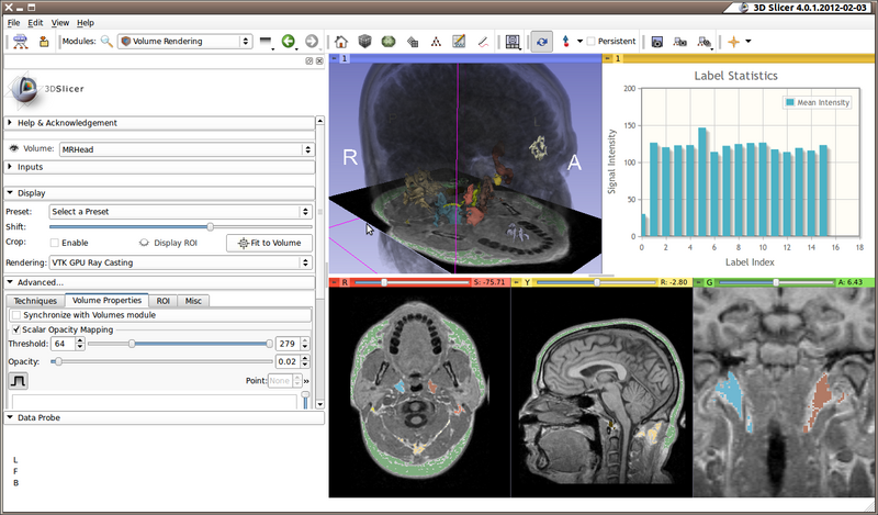 File:3D Slicer 4.0.1.2012-02-03 180.png
