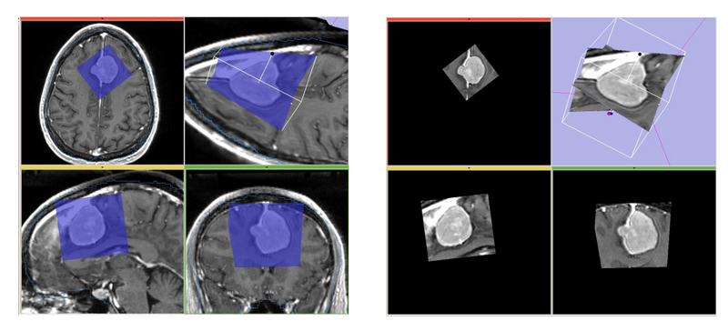 File:ExtractSubvolumeROI gallery.png