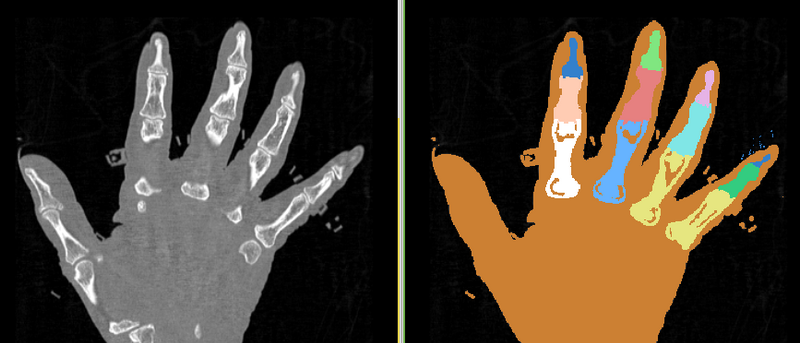 File:EMS Result Hand subject2.png