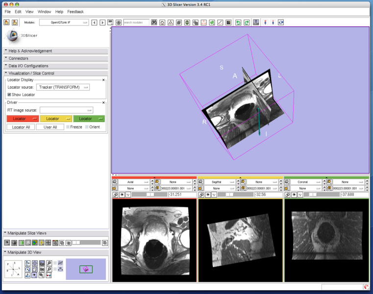 File:Slicer3 OpenIGTLinkIF VolumeReslice1.png