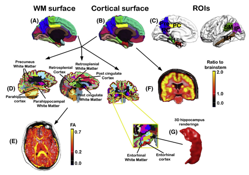 File:Walhovd-Neuroimage2009-fig2.png