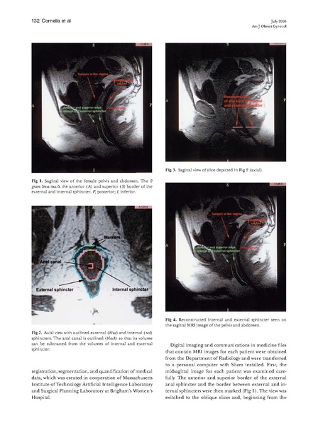 File:Cornella-AJOG2003.pdf