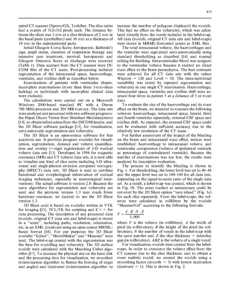 File:Strik-Neuroradiology2005.pdf