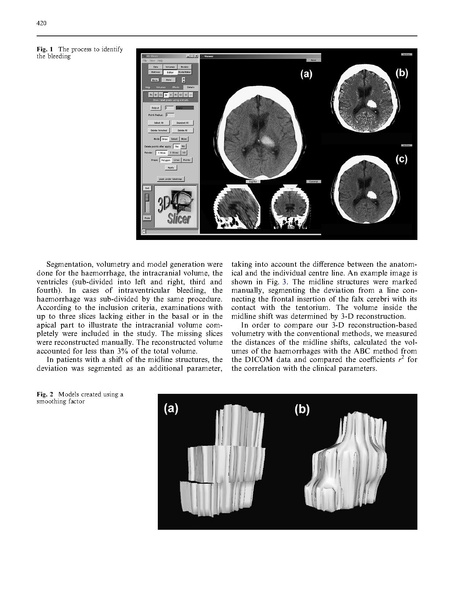 File:Strik-Neuroradiology2005.pdf
