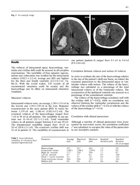 File:Strik-Neuroradiology2005.pdf