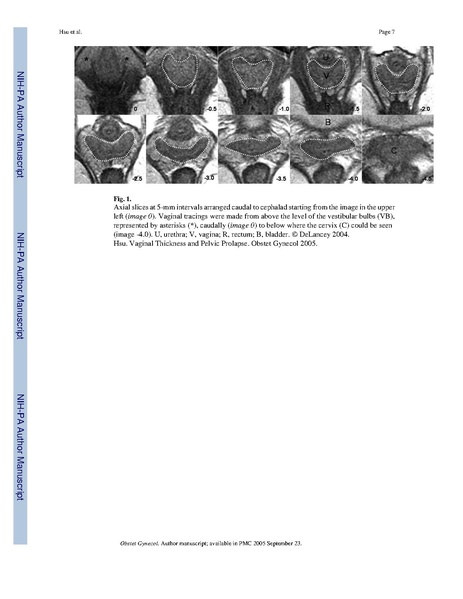 File:Hsu-ObstetGynecol2005May.pdf
