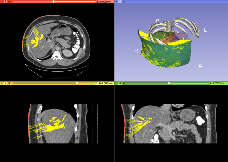File:PercutaneousPathDesignerView8.png