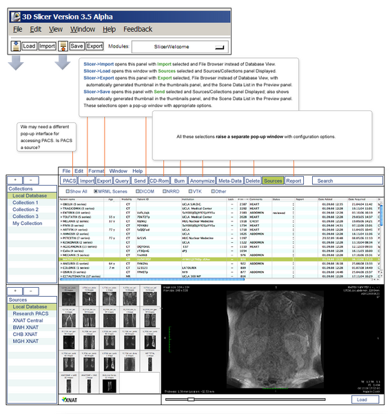 File:SlicerXNDLayout Draft2.png