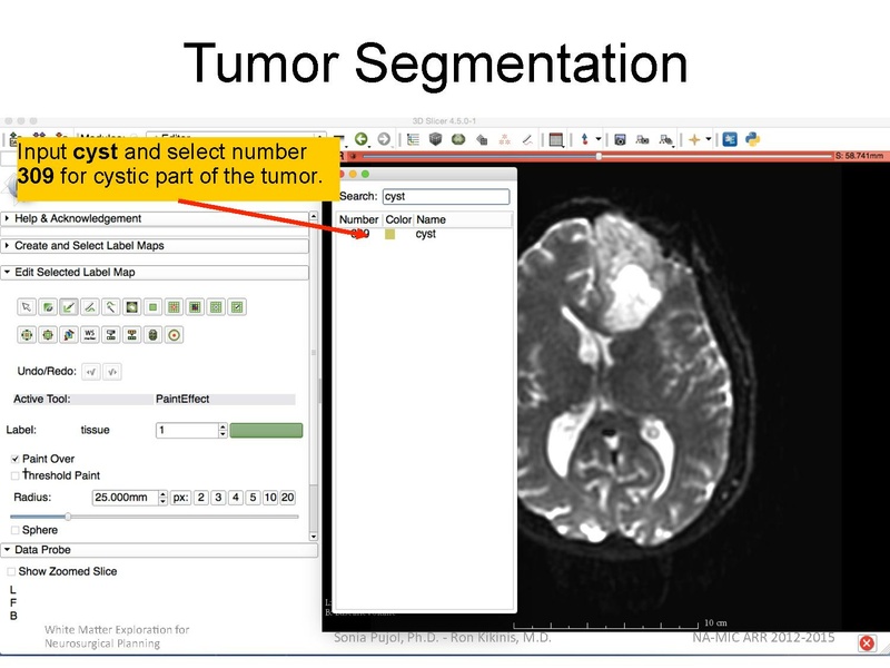 File:WhiteMatterExplorationTutorial SoniaPujol Slicer4.5.pdf
