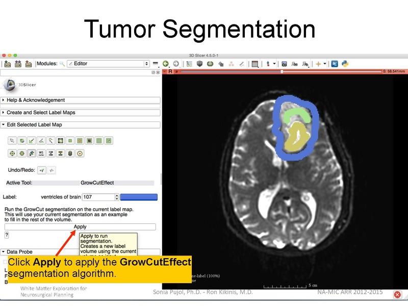 File:WhiteMatterExplorationTutorial SoniaPujol Slicer4.5.pdf