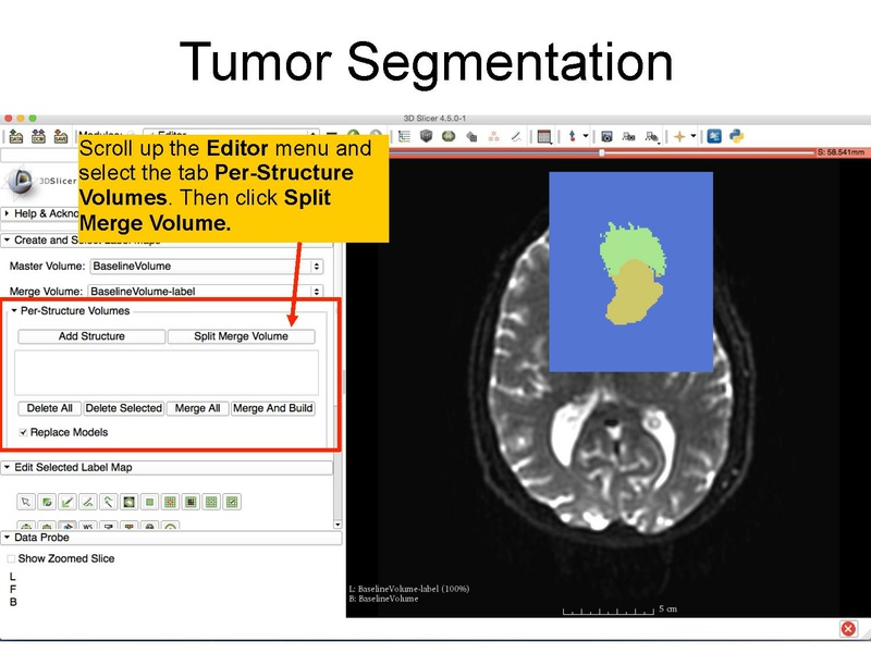 File:WhiteMatterExplorationTutorial SoniaPujol Slicer4.5.pdf