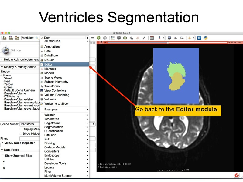 File:WhiteMatterExplorationTutorial SoniaPujol Slicer4.5.pdf