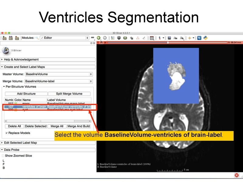 File:WhiteMatterExplorationTutorial SoniaPujol Slicer4.5.pdf