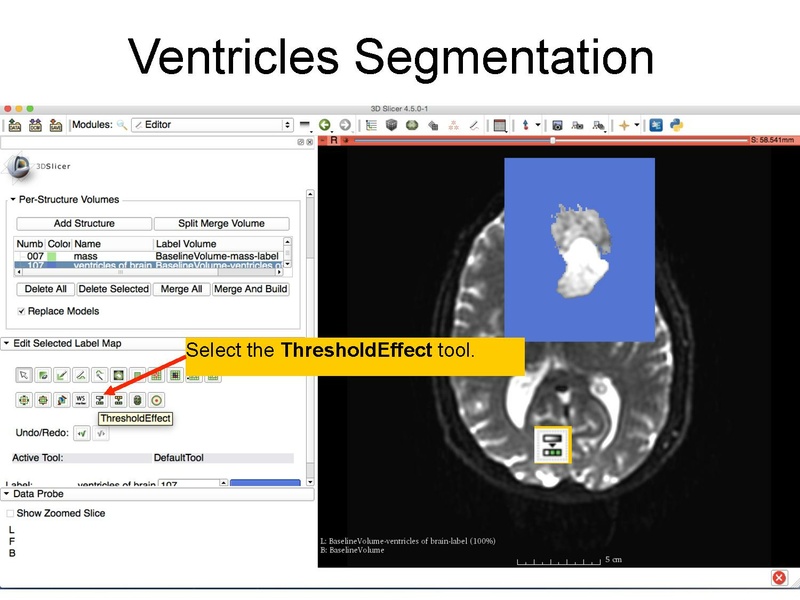 File:WhiteMatterExplorationTutorial SoniaPujol Slicer4.5.pdf