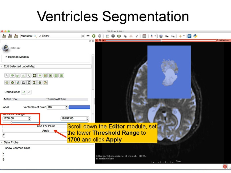 File:WhiteMatterExplorationTutorial SoniaPujol Slicer4.5.pdf