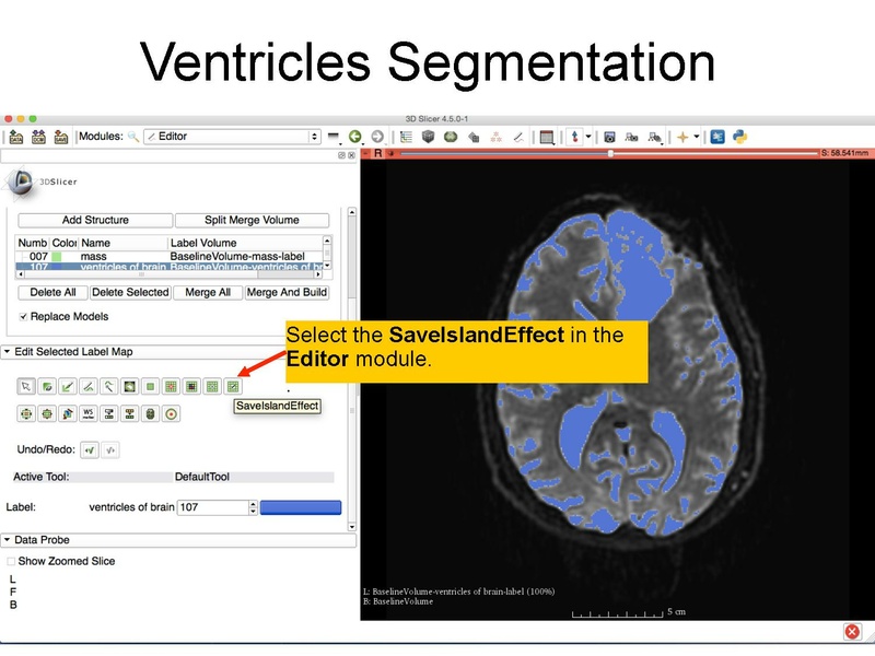 File:WhiteMatterExplorationTutorial SoniaPujol Slicer4.5.pdf