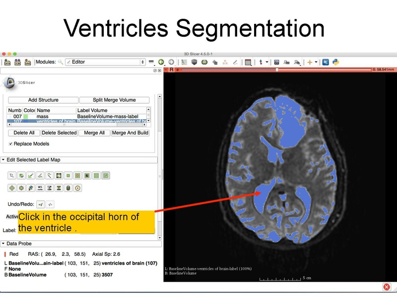File:WhiteMatterExplorationTutorial SoniaPujol Slicer4.5.pdf