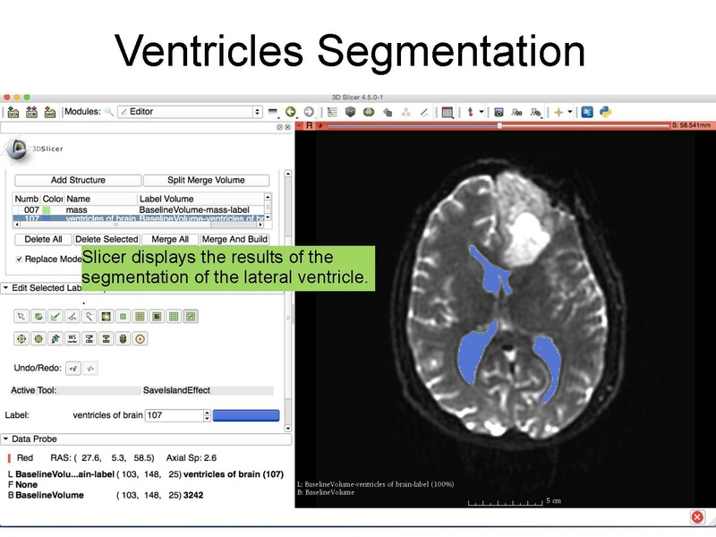 File:WhiteMatterExplorationTutorial SoniaPujol Slicer4.5.pdf