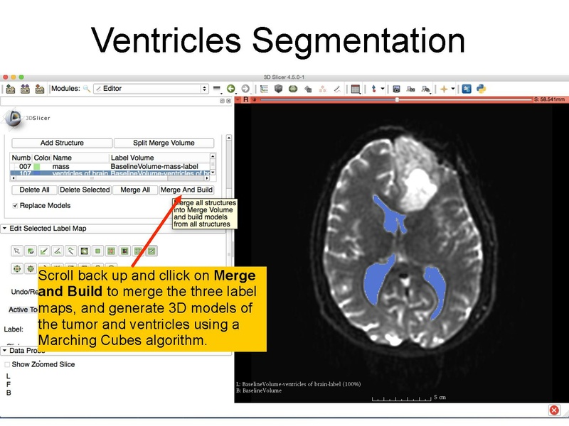 File:WhiteMatterExplorationTutorial SoniaPujol Slicer4.5.pdf