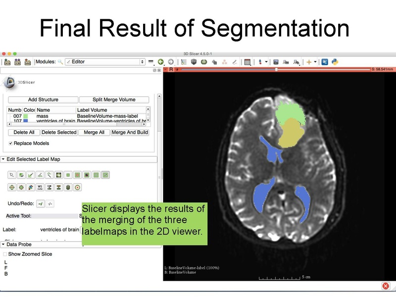 File:WhiteMatterExplorationTutorial SoniaPujol Slicer4.5.pdf