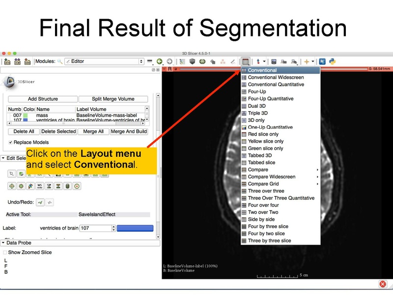 File:WhiteMatterExplorationTutorial SoniaPujol Slicer4.5.pdf