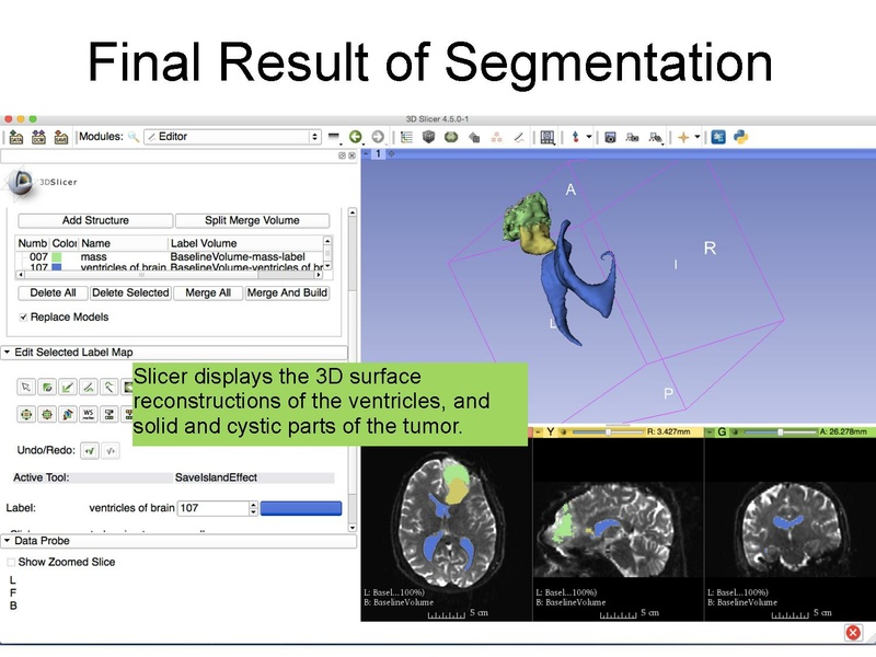 File:WhiteMatterExplorationTutorial SoniaPujol Slicer4.5.pdf