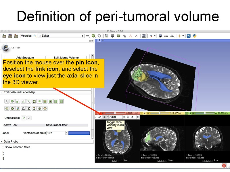 File:WhiteMatterExplorationTutorial SoniaPujol Slicer4.5.pdf