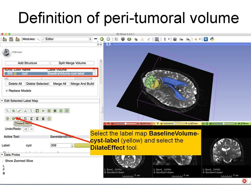 File:WhiteMatterExplorationTutorial SoniaPujol Slicer4.5.pdf