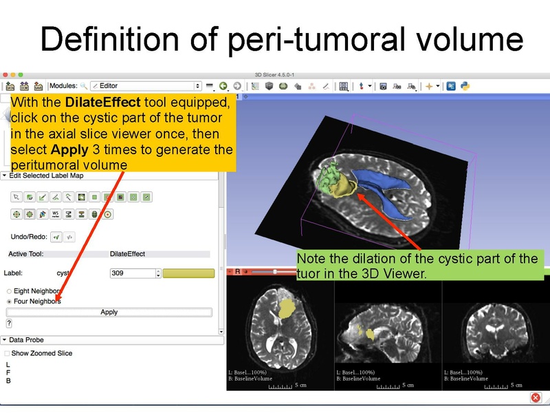 File:WhiteMatterExplorationTutorial SoniaPujol Slicer4.5.pdf