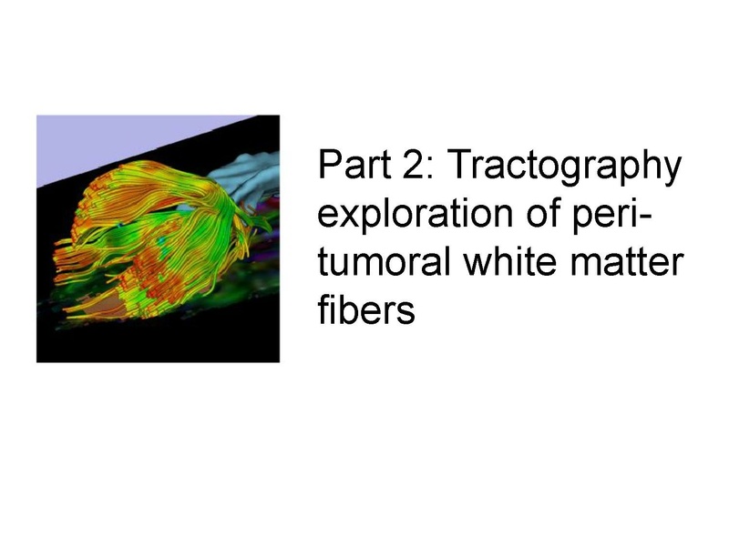 File:WhiteMatterExplorationTutorial SoniaPujol Slicer4.5.pdf