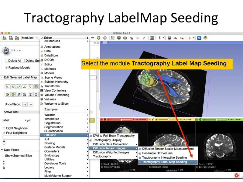 File:WhiteMatterExplorationTutorial SoniaPujol Slicer4.5.pdf