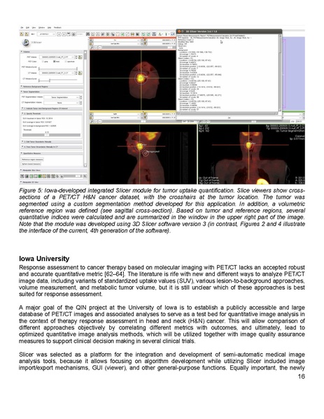 File:Fedorov 3DSlicer MRI.pdf