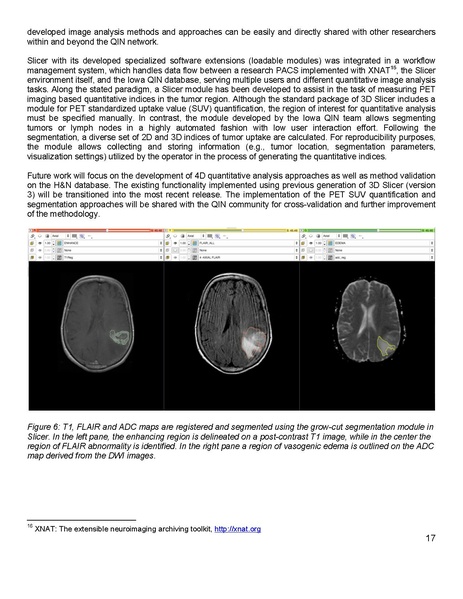 File:Fedorov 3DSlicer MRI.pdf