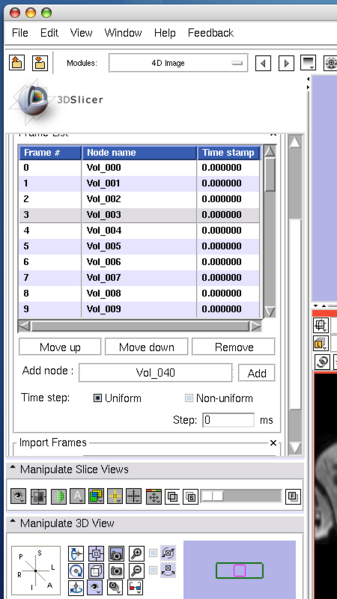 File:FourDImage EditRemove.png