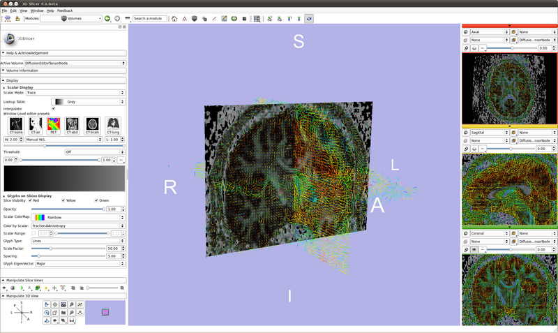 File:SlicerWithDTI.png