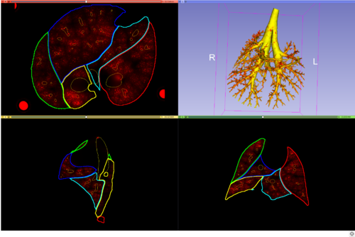 Loaded standard file selection