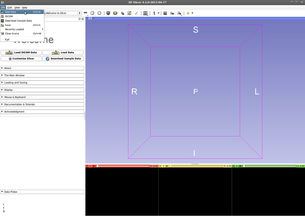 Documentation/4.3/Modules/KSliceInteractiveSegmenter - Slicer Wiki