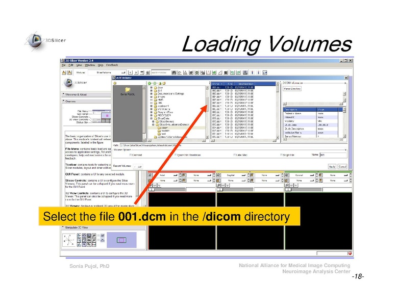 File:Slicer3Course DataLoading 3DVisualization SoniaPujol.pdf