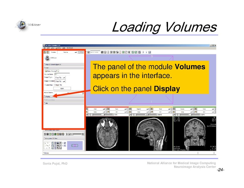 File:Slicer3Course DataLoading 3DVisualization SoniaPujol.pdf
