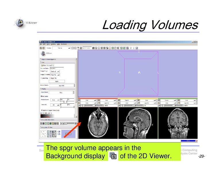 File:Slicer3Course DataLoading 3DVisualization SoniaPujol.pdf