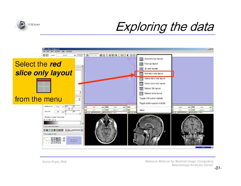 File:Slicer3Course DataLoading 3DVisualization SoniaPujol.pdf