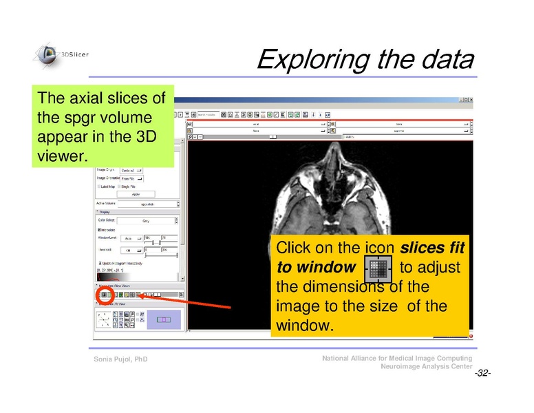 File:Slicer3Course DataLoading 3DVisualization SoniaPujol.pdf