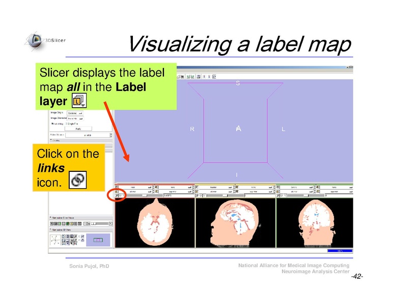 File:Slicer3Course DataLoading 3DVisualization SoniaPujol.pdf