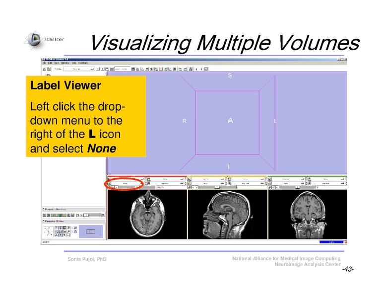 File:Slicer3Course DataLoading 3DVisualization SoniaPujol.pdf